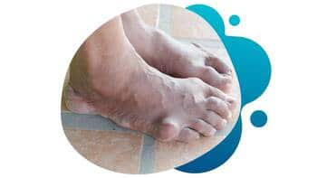 Conquest Research Gout Study – Research Studies Knowing what foods trigger gouts.