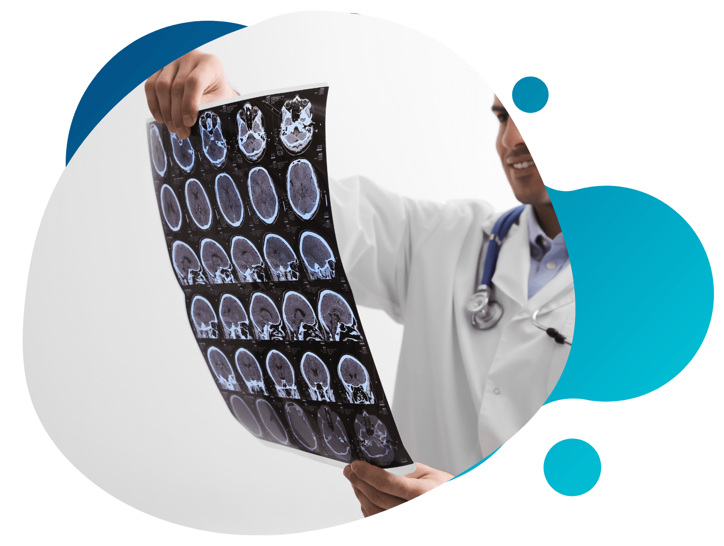 Multiple Sclerosis Clinical Studies
