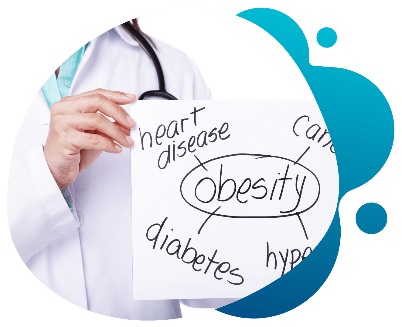 Obesity-related health conditions written on board