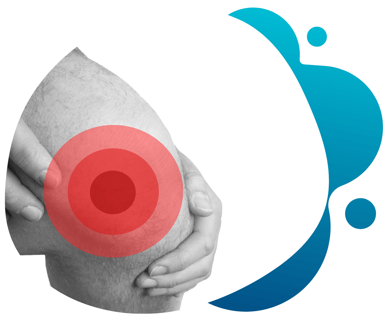 Illustration of knee joint pain