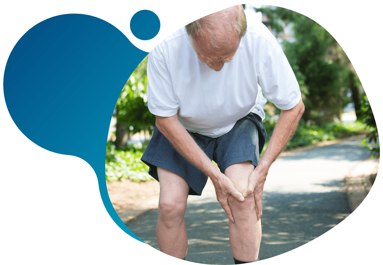 Knee Osteoarthritis
