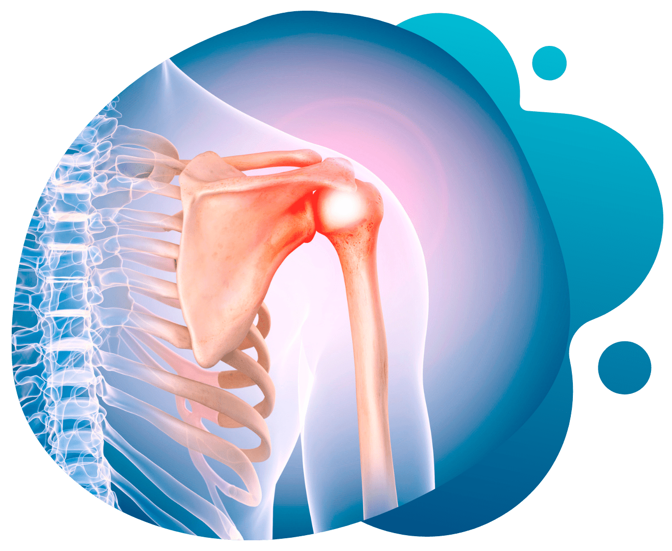 Shoulder joint pain