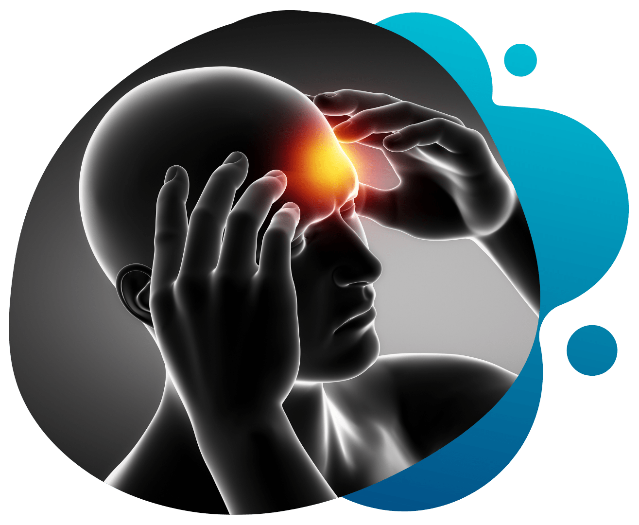 Struggling With Migraine pain