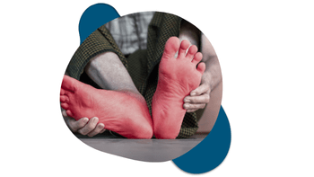 CIPN Website Element man grabbing his foot from neuropathy pain