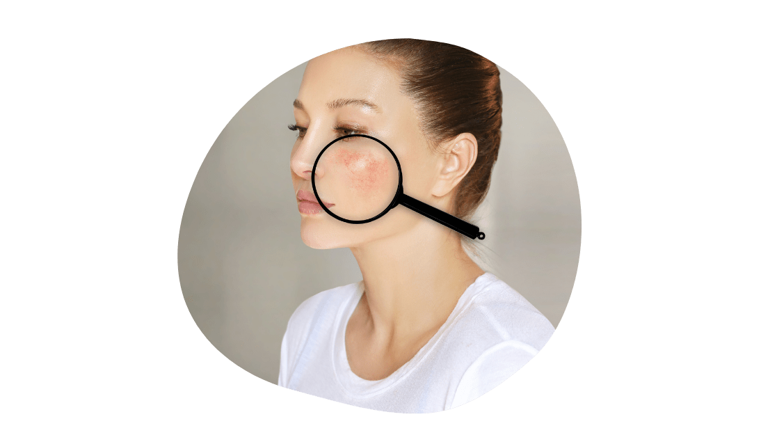 Woman examining facial skin with magnifying glass for pigmentation