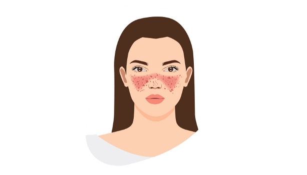 Side view of woman checking skin for blemishes or rashes