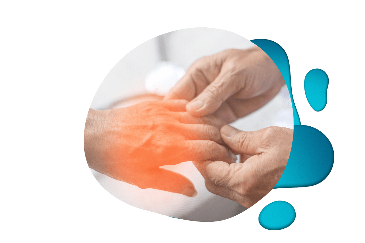 Website Elements (1200 x 800 px) Person with inflamed red joints on hand indicating arthritis symptoms